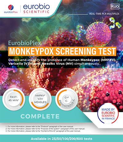 New proprietary test for the diagnosis of Monkeypox