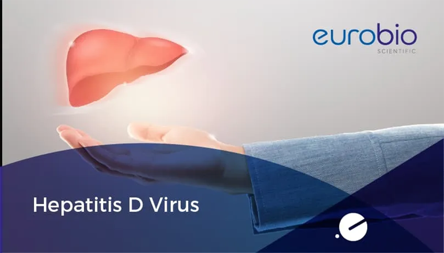 Hepatitis D Virus: Diagnostic Complexity and Public Health Challanges in 2025